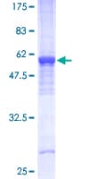 Human PHB / Prohibitin Protein (Recombinant GST)