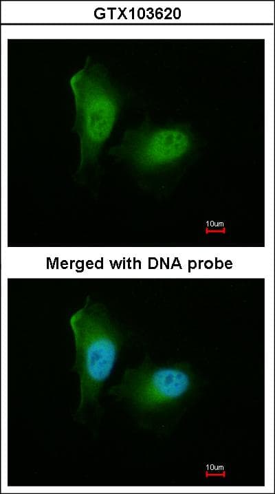 PSMA2 Antibody (aa1-234)