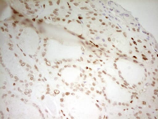 MEF2D Antibody (aa1-282, clone OTI3D12)