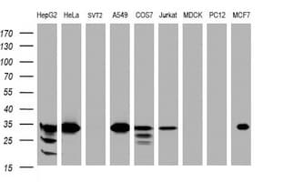 ING2 Antibody (clone OTI3B11, Carrier-free)