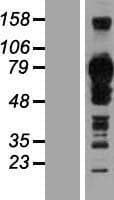 TJAP1 Protein (Over-Expression Lysate Myc-DDK (Flag))