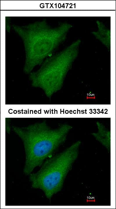 SOCS4 Antibody (aa376-440)
