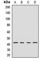 DNAJB14 Antibody