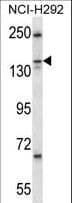 KIF16B Antibody (aa1-30)