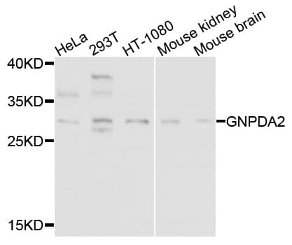 Polyclonal Rabbit anti-Human GNPDA2 Antibody (WB)