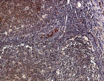 CCR1 Antibody (aa7-24)