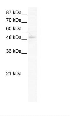 Polyclonal Rabbit anti-Human SIRT7 / Sirtuin 7 Antibody (aa317-366, IHC, WB)
