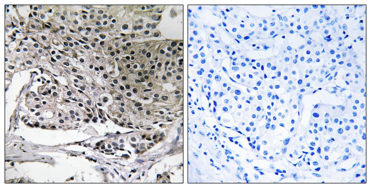 Polyclonal Rabbit anti-Human PIGY Antibody (aa3-52, IHC)