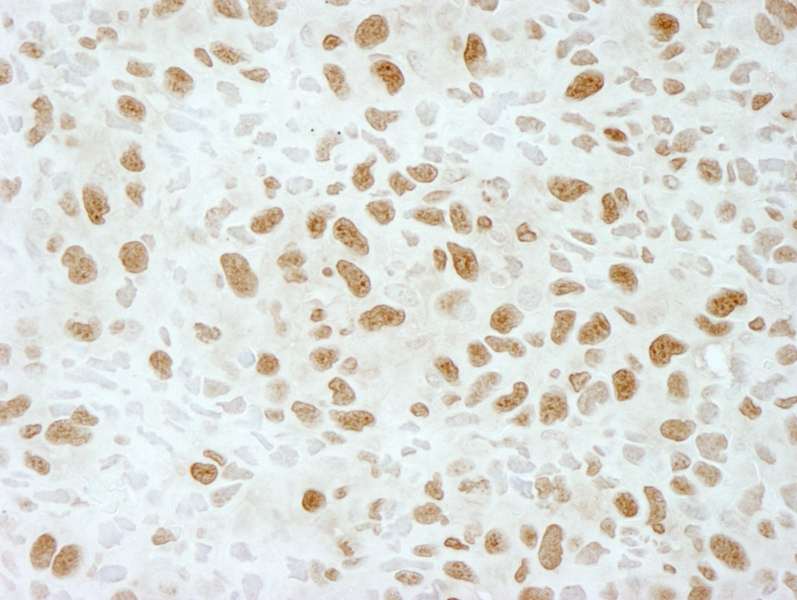 Polyclonal Rabbit anti-Human BRD4 Antibody (aa1312-1362, IHC)