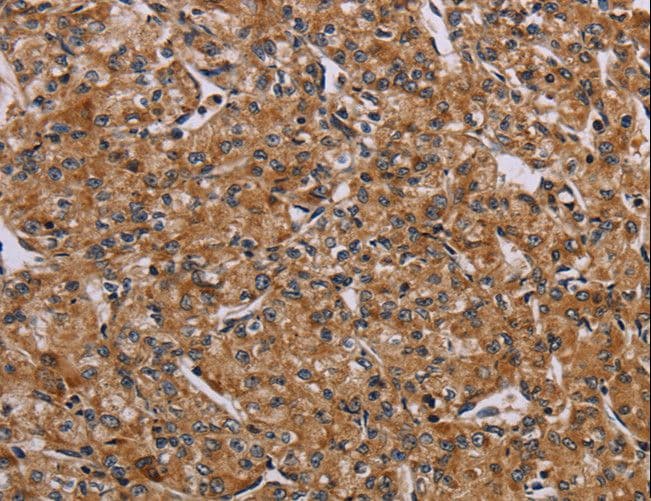 AATK / AATYK Antibody
