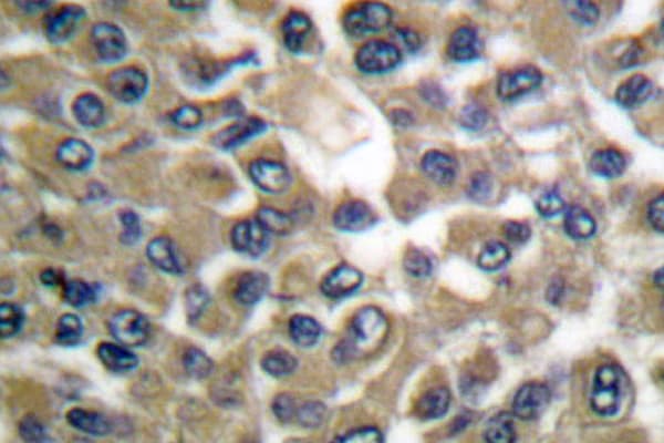 MMP19 Antibody (Gly44)