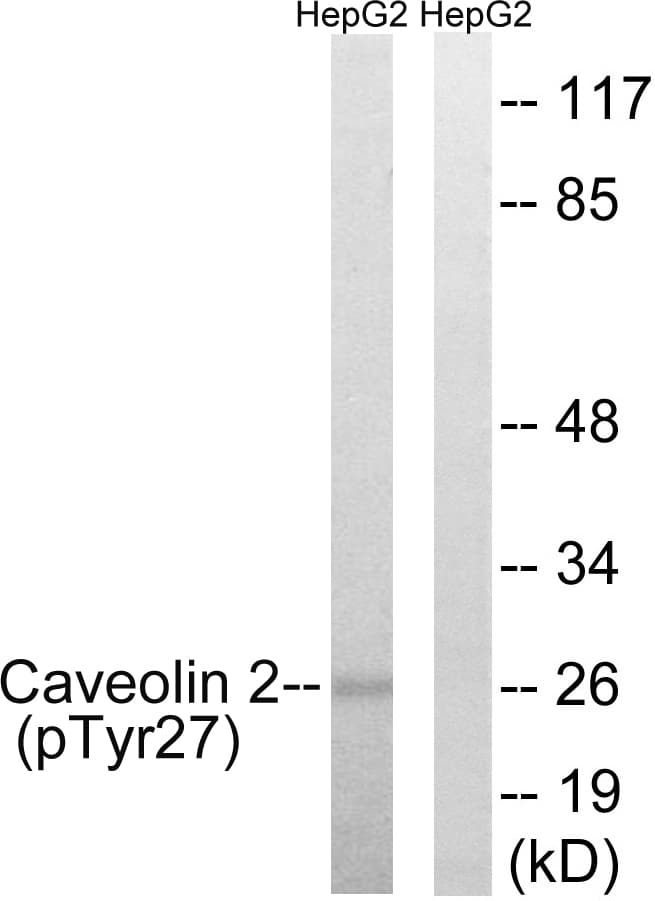 CAV2 / Caveolin 2 Antibody (phospho-Tyr27)