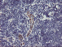PGM3 Antibody (clone OTI1B8)