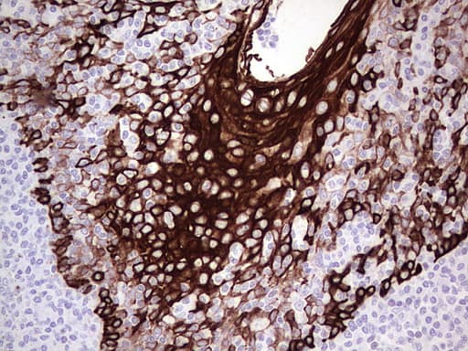 KRT19 / CK19 / Cytokeratin 19 Antibody (aa240-390, clone UMAB186)