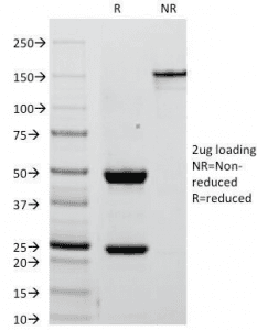 PLAP / Alkaline Phosphatase Antibody (clone ALPP/238)