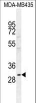 CLEC10A / CD301 Antibody (aa1-30)