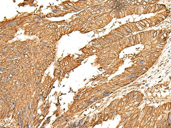 Polyclonal Rabbit anti-Human P2RY14 / GPR105 Antibody (IHC)