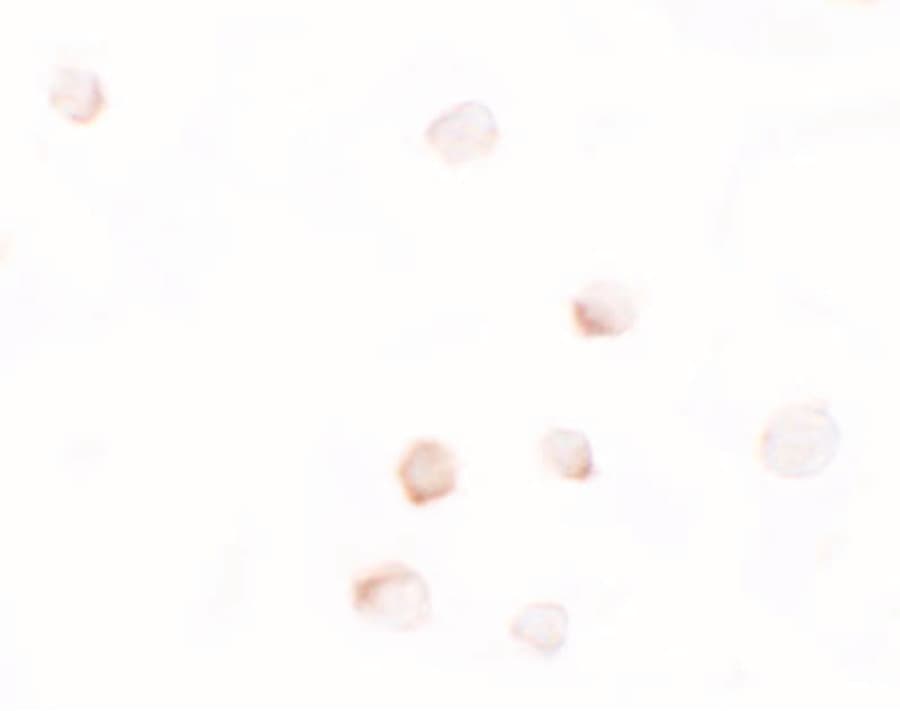 DLK1 / Pref-1 Antibody