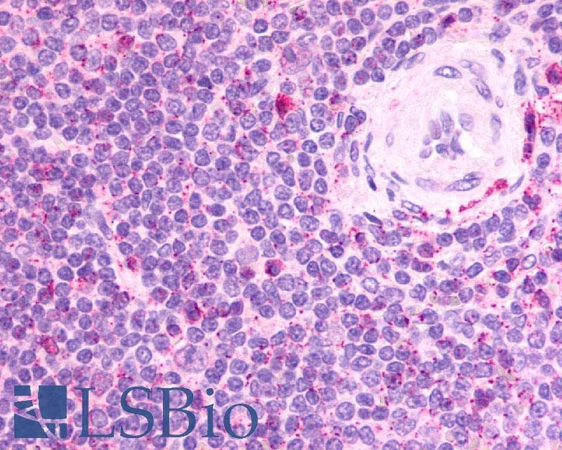 PathPlus™ Polyclonal Rabbit anti-Human CXCR2 Antibody (Extracellular Domain, IHC)