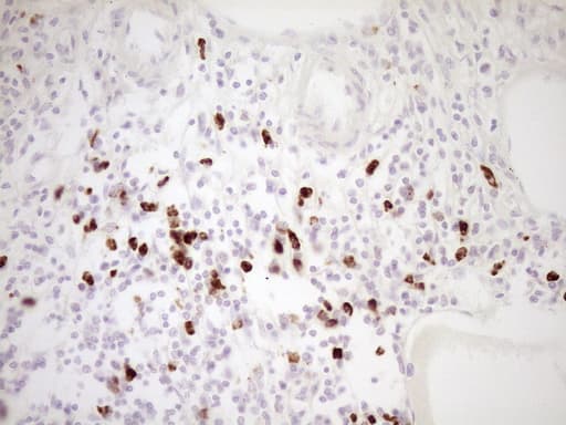 TFPI / LACI Antibody (aa29-304, clone OTI5H5)