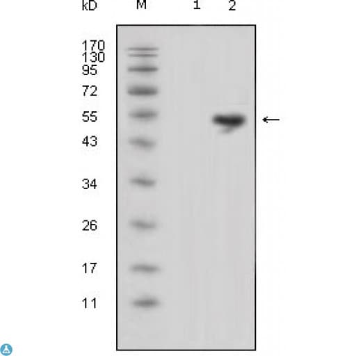 Monoclonal Mouse anti-Human LCN1 / Lipocalin-1 Antibody (IHC, IF, WB)