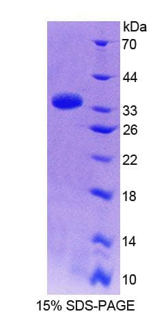 Human PPFIA1 / LIPRIN Protein (Recombinant His-T7, N-terminus)