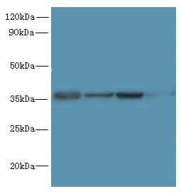 Polyclonal Rabbit anti-Human PDCD1 / CD279 / PD-1 Antibody (IHC, WB)