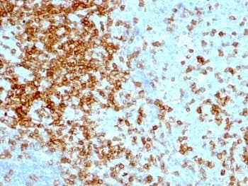 SPN / CD43 Antibody (clone 84-3C1)