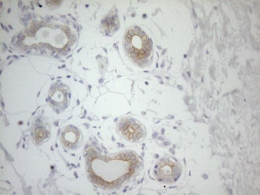 PD-L2 / PDCD1LG2 / CD273 Antibody (clone UMAB223)