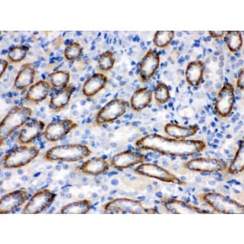 Polyclonal Rabbit anti-Human CYP1B1 Antibody (aa255-480, IHC, WB)