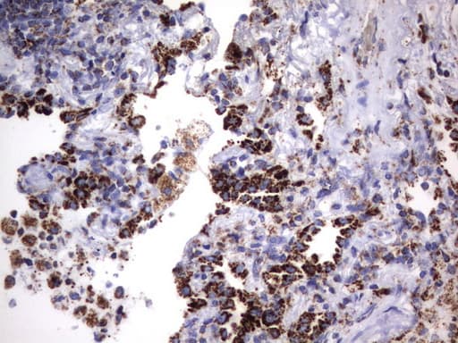 HADH Antibody (aa57-314, clone UMAB151, Carrier-free)