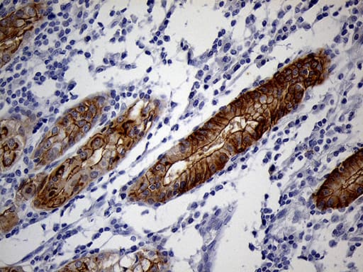 LAD1 Antibody (aa271-517, clone OTI7H8)