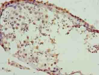 SLC26A8 / TAT1 Antibody