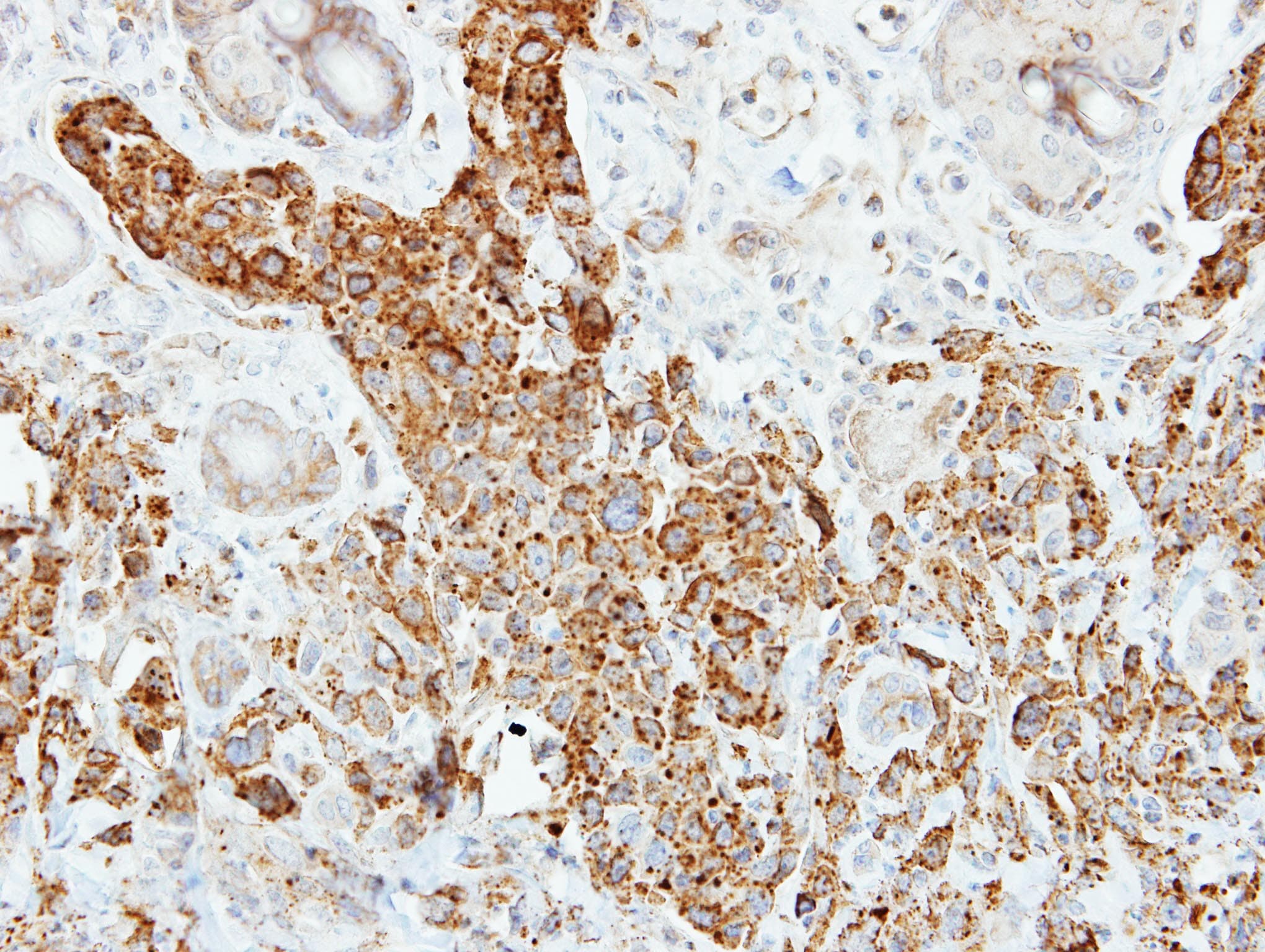 Polyclonal Rabbit anti-Human PNLIP / PL / Pancreatic Lipase Antibody (aa21-300, IHC, WB)