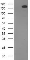 TBC1D4 / AS160 Antibody (clone OTI5E6)