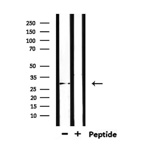 Polyclonal Rabbit anti-Human TSSK6 Antibody (WB)
