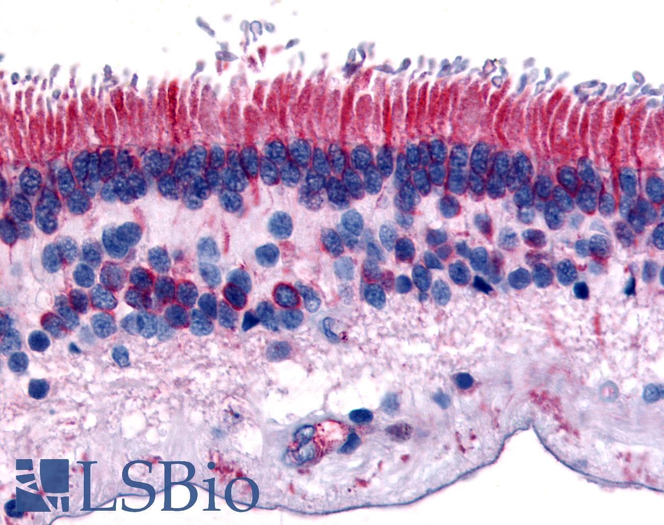 IHC-plus™ PTPRM / PTP Mu Antibody (Internal)