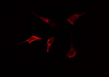 Polyclonal Rabbit anti-Human DOK5 Antibody (IF, WB)