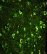 IHC-plus™ ABI1 / SSH3BP1 Antibody (aa81-108)