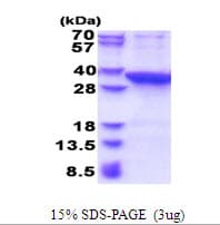 Human PROSC Protein (Recombinant His)