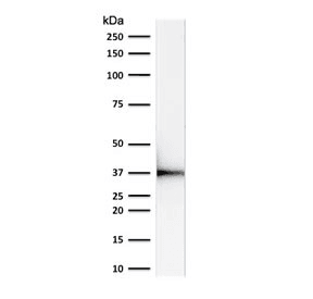 Monoclonal Mouse anti-Human EMD / Emerin Antibody (clone EMD/2168, IHC, WB)