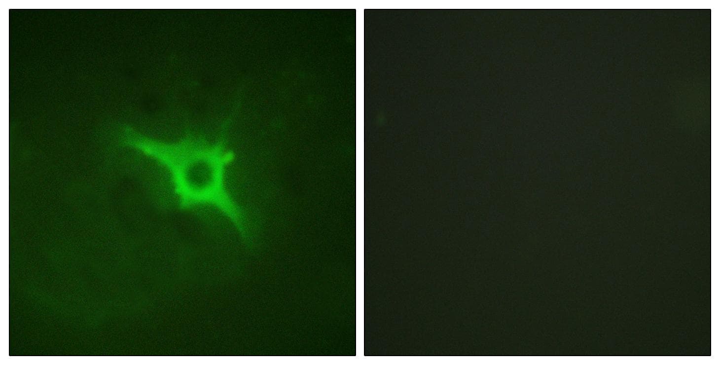 Polyclonal Rabbit anti-Human NCF1 / p47phox / p47 phox Antibody (Ab-328, IHC, IF)