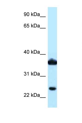 DDX / AKR1C3 Antibody (aa97-146)