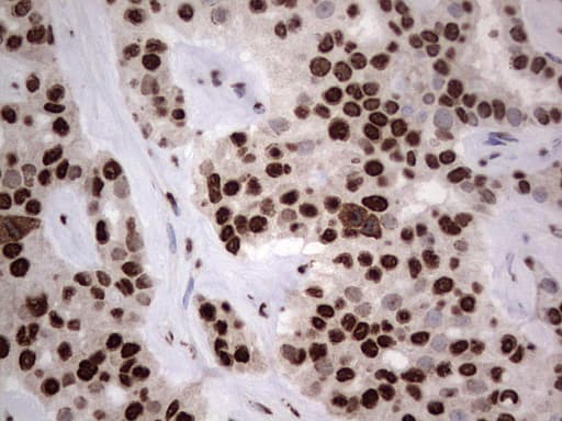 HNRNPL / hnRNP L Antibody (aa270-502, clone OTI2E4)