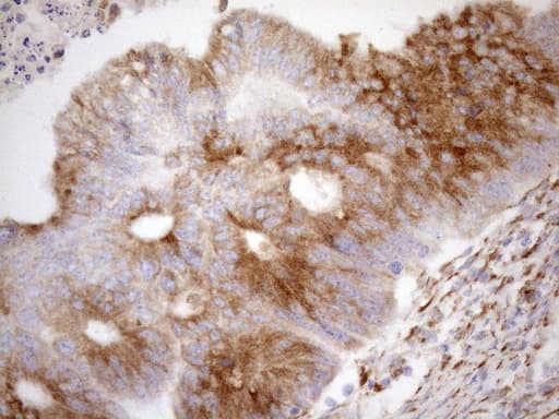 Monoclonal Mouse anti-Human NT5E / eNT / CD73 Antibody (clone OTI1G2, Carrier-free, aa119-232, IHC, WB)