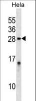 Polyclonal Rabbit anti-Human IPP2 / PPP1R2 Antibody (aa119-148, WB)