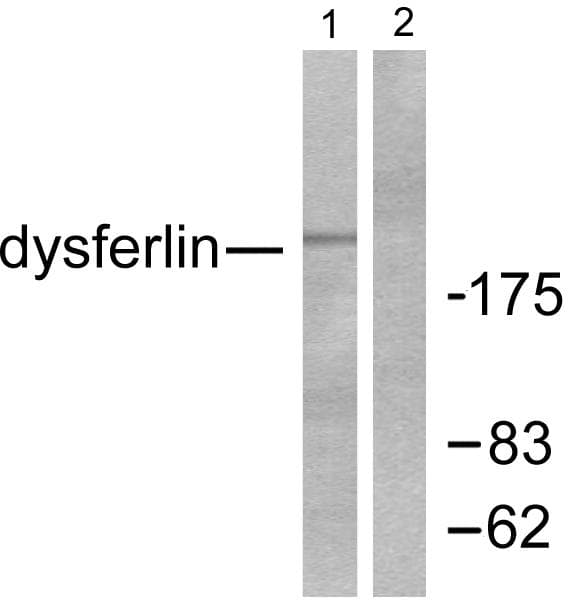 Polyclonal Rabbit anti-Human Dysferlin Antibody (WB)