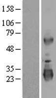 Human LRRC3 Protein (Over-Expression Lysate Myc-DDK (Flag))