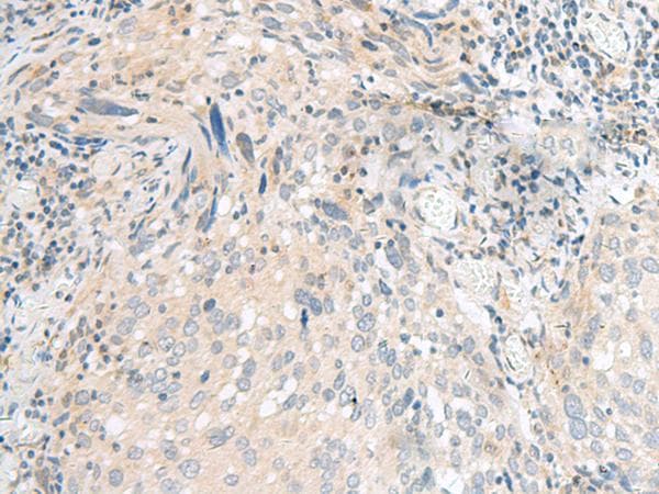 Polyclonal Rabbit anti-Human CALCOCO1 / CoCoa Antibody (IHC)