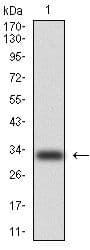 KRT5 / CK5 / Cytokeratin 5 Antibody (clone 2C2)
